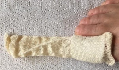 Tube gauze placed over toe