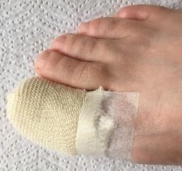 Big Toe with bandage on, taped at the bottom